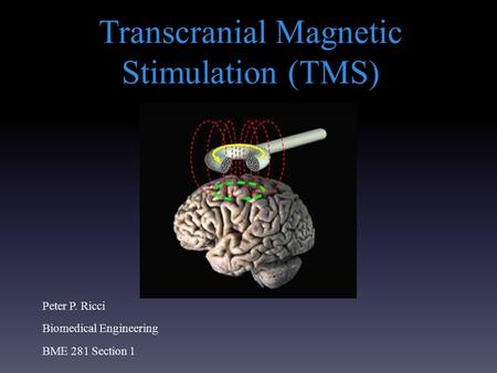 Transcranial Magnetic Stimulation (TMS)