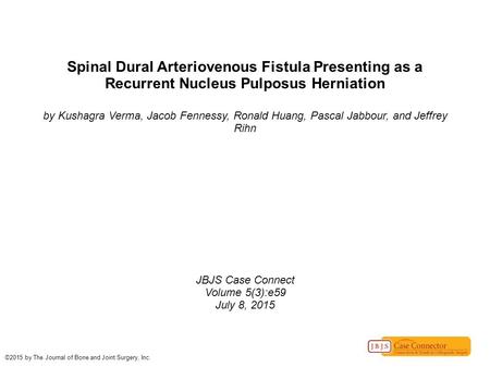 Spinal Dural Arteriovenous Fistula Presenting as a Recurrent Nucleus Pulposus Herniation by Kushagra Verma, Jacob Fennessy, Ronald Huang, Pascal Jabbour,