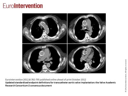 © 2012 EuroIntervention. All rights reserved. EuroIntervention 2012;8:782-795 published online ahead of print October 2012 Updated standardized endpoint.