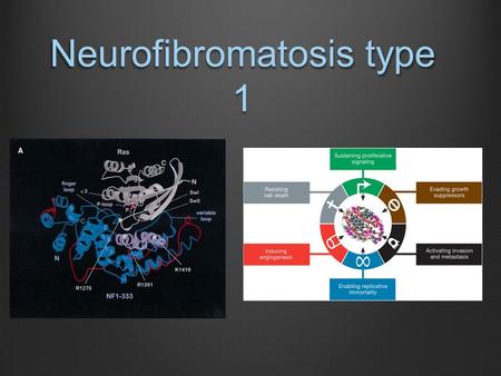 Neurofibromatosis type 1. Biallelic NF1 inactivation leads to multiple symptoms.