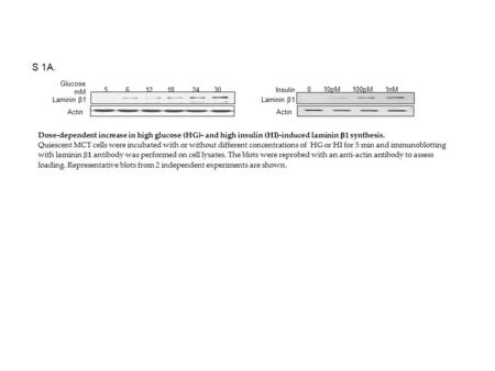 Glucose mM Laminin β1 Actin 5612182430 Insulin Laminin β1 Actin 010pM100pM1nM S 1A. Dose-dependent increase in high glucose (HG)- and high insulin (HI)-induced.