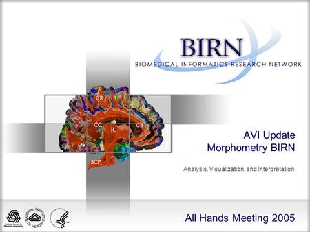 All Hands Meeting 2005 AVI Update Morphometry BIRN Analysis, Visualization, and Interpretation.