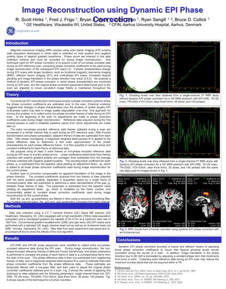 Image Reconstruction using Dynamic EPI Phase Correction Magnetic resonance imaging (MRI) studies using echo planar imaging (EPI) employ data acquisition.