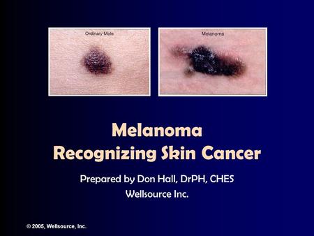 © 2005, Wellsource, Inc. Melanoma Recognizing Skin Cancer Prepared by Don Hall, DrPH, CHES Wellsource Inc.