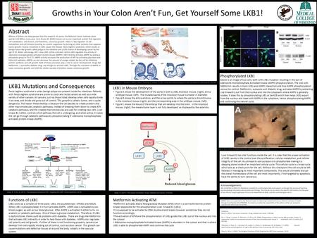 Growths in Your Colon Aren’t Fun, Get Yourself Some LKB1! Abstract Billions of dollars are being poured into the research of cancer, the National Cancer.