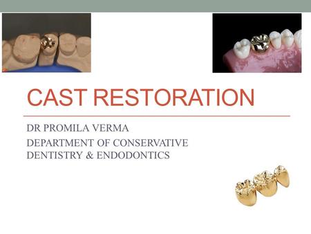 DR PROMILA VERMA DEPARTMENT OF CONSERVATIVE DENTISTRY & ENDODONTICS