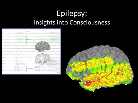 Epilepsy: Insights into Consciousness. Obligatory Historical Quote: “Men ought to know that from the brain… madness comes from its moistness. When the.