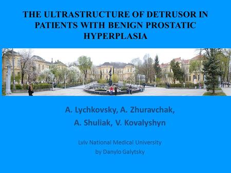 THE ULTRASTRUCTURE OF DETRUSOR IN PATIENTS WITH BENIGN PROSTATIC HYPERPLASIA A. Lychkovsky, A. Zhuravchak, A. Shuliak, V. Kovalyshyn Lviv National Medical.