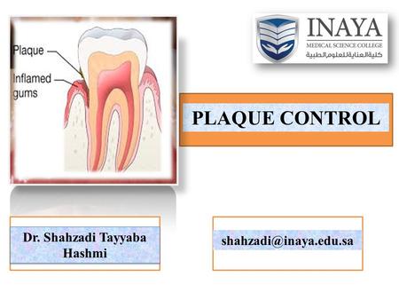 PLAQUE CONTROL Dr. Shahzadi Tayyaba Hashmi