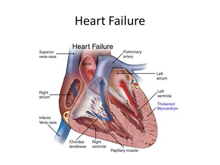 Heart Failure. Background to Congestive Heart Failure Normal cardiac output needed to adequately perfuse peripheral organs – Provide O 2, nutrients, etc.