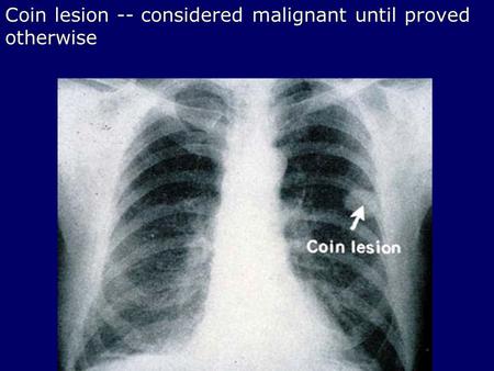 Coin lesion -- considered malignant until proved otherwise.