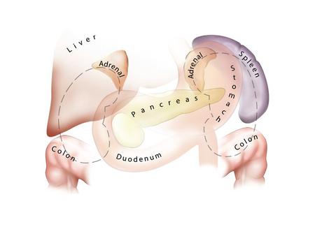 Laparoscopic Surgery 55 of the Kidney Pyelolithotomy, Nephrolithotomy, and Ureterolithotomy.