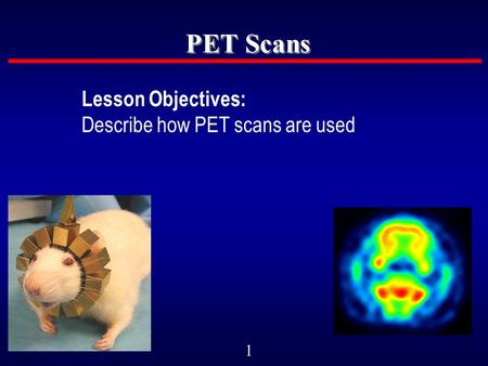 1 PET Scans Lesson Objectives: Describe how PET scans are used.