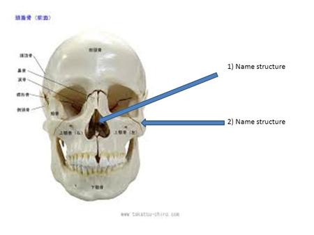 1) Name structure 2) Name structure. 3) Name suture 4) Name structure.