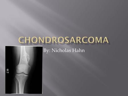 By: Nicholas Hahn.  A lump or tumor accompanied with pain. Although severity in pain depends on the size and location of the tumor. Tumors can weaken.