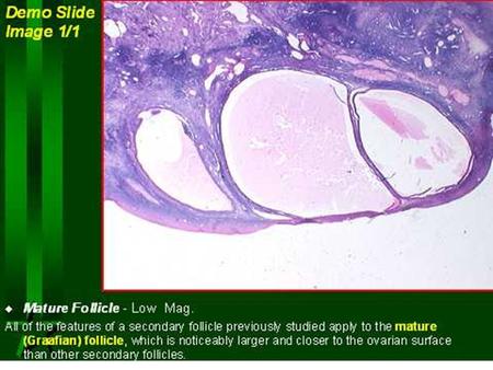 Ovulation Definition: The process of in which mature follicle ruptures and the secondary oocyte with zona pellucida & corona radiata is expelled into.