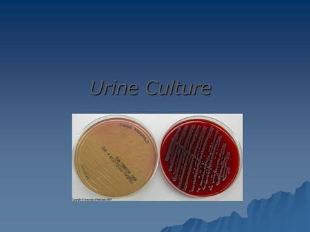 Urine Culture.