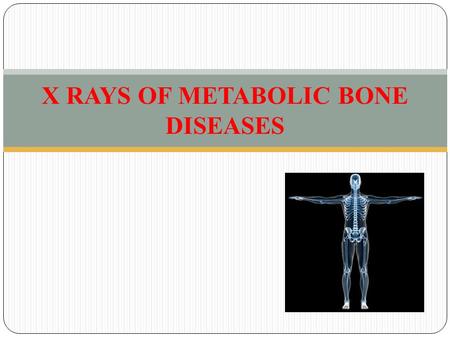 X RAYS OF METABOLIC BONE DISEASES