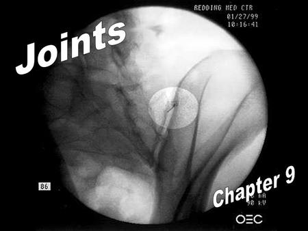 Classified structurally and functionally presence or absence of synovial cavity presence or absence of synovial cavity type of binding connective tissue.