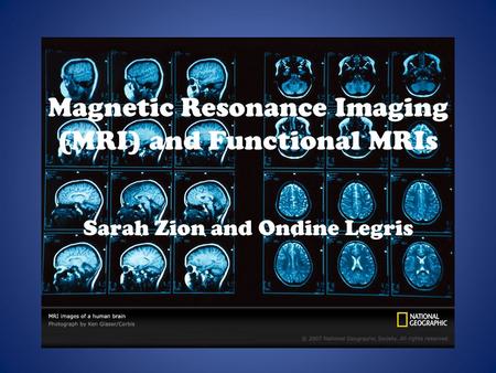 Magnetic Resonance Imaging (MRI) and Functional MRIs Sarah Zion and Ondine Legris.