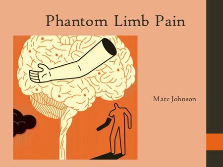 Phantom Limb Pain Marc Johnson Rationale, Purpose, and Summary  Personal connection to this topic and this pain is common in a majority of amputees.