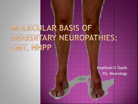 Haythum O Tayeb R3, Neurology.  Brief review of the genetics and molecular biology of CMT & HNPP with clinical correlation.