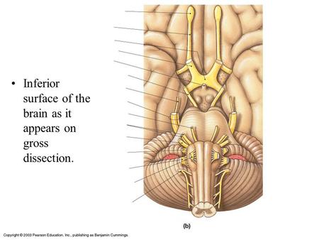 Inferior surface of the brain as it appears on gross dissection.