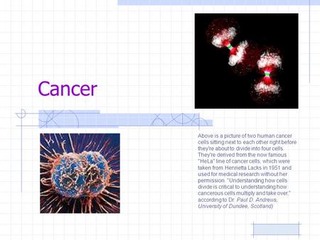 Cancer Above is a picture of two human cancer cells sitting next to each other right before they're about to divide into four cells. They're derived from.