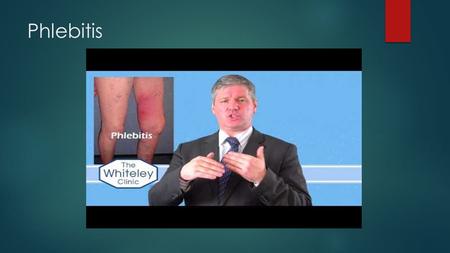 Phlebitis. Phleborrhaphy sewing up a gap Phleborrhagia  phleborrhagia phleb·or·rha·gi·a (flěb' ə -rā'jē- ə, -j ə ) n. Venous hemorrhage.