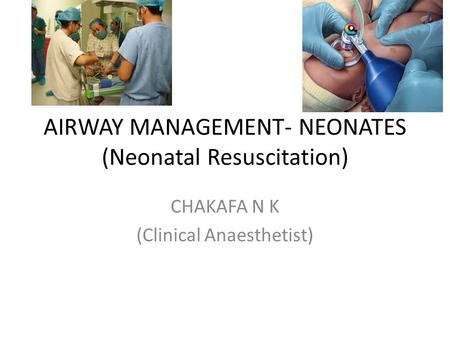 AIRWAY MANAGEMENT- NEONATES (Neonatal Resuscitation)