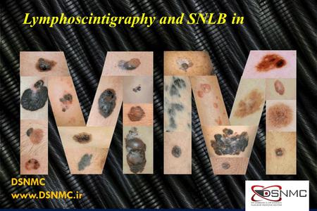 Lymphoscintigraphy and SNLB in