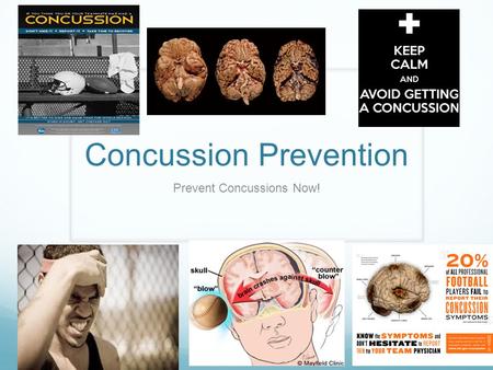 Concussion Prevention