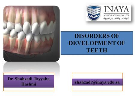 DISORDERS OF DEVELOPMENT OF TEETH Dr. Shahzadi Tayyaba Hashmi