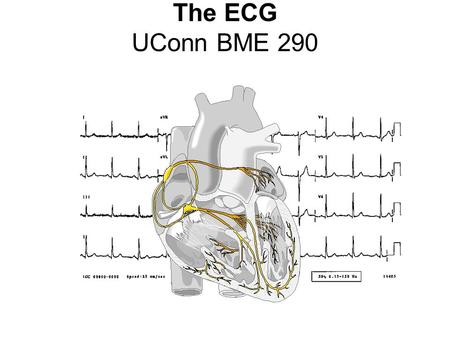 The ECG UConn BME 290. Buffers What is a buffer? –Non-inverting amplifier with a gain of 1 Why use a buffer? –Buffers provide a high input impedance.