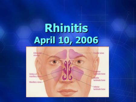 Rhinitis April 10, 2006. THE NOSE CT of THE NOSE.