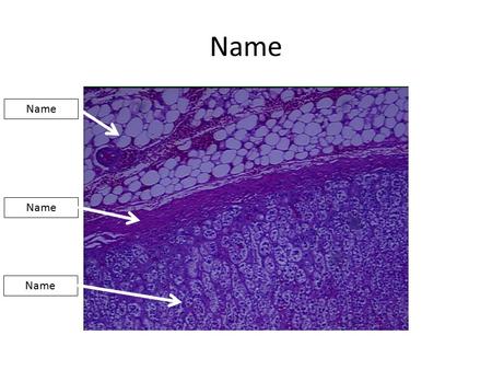 Name. Adrenal Gland Capsule Cortex Adipose Name.