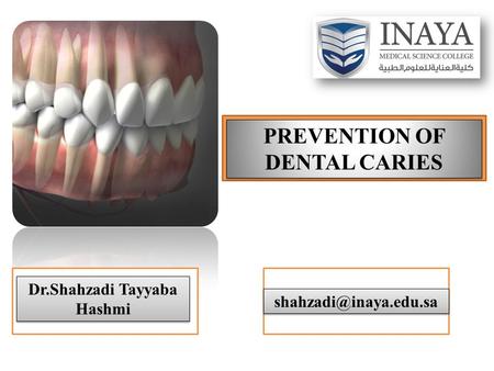 PREVENTION OF DENTAL CARIES Dr.Shahzadi Tayyaba Hashmi