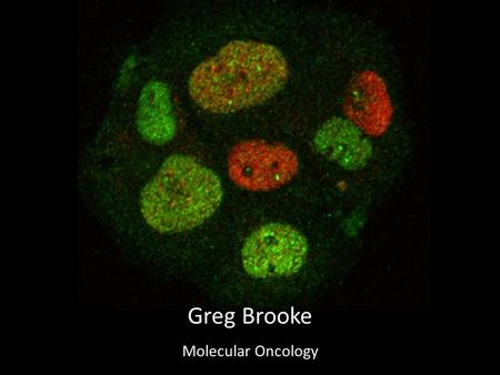 Greg Brooke Molecular Oncology. Prostate Cancer - Leading Cause of Cancer- related death in men - Growth dependent on androgens - Therapy targets androgen.