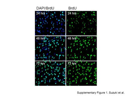 Supplementary Figure 1. Suzuki et al. DAPI/BrdU BrdU 24 hrs 48 hrs 72 hrs.