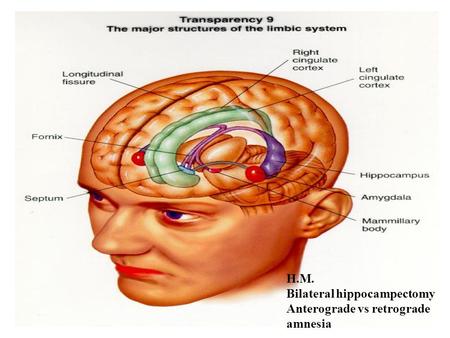 H.M. Bilateral hippocampectomy Anterograde vs retrograde amnesia.