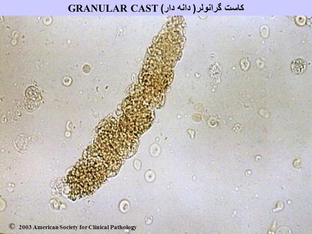 GRANULAR CASTکاست گرانولر( دانه دار)