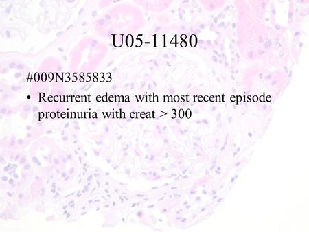 U05-11480 #009N3585833 Recurrent edema with most recent episode proteinuria with creat > 300.