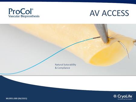 Natural Suturability & Compliance AV ACCESS ML0951.000 (06/2015)