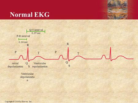 Copyright © 2006 by Elsevier, Inc. P-R interval 0.16 sec P T R Q S Q-T interval 0.35 sec Atrial depolarization Ventricular depolarizatio n Ventricular.