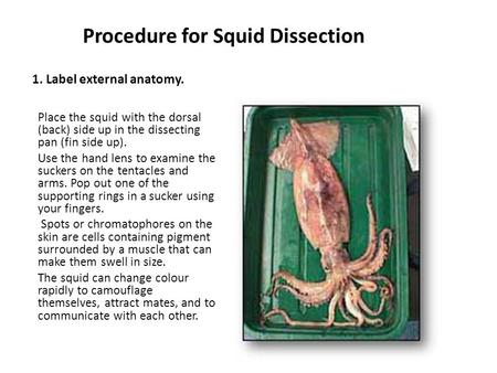 1. Label external anatomy.