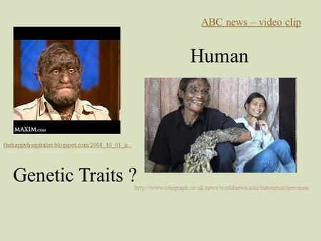 Human Genetic Traits ? ABC news – video clip thehappyhospitalist.blogspot.com/2008_10_01_a...