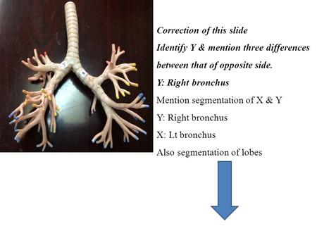 Correction of this slide Identify Y & mention three differences between that of opposite side. Y: Right bronchus Mention segmentation of X & Y Y: Right.