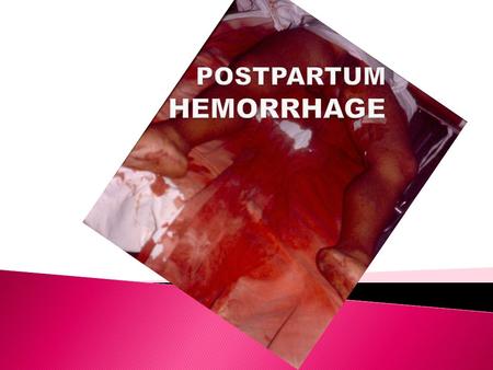  To understand the importance of prompt and appropriate management in saving lives from PPH ◦ Define PPH ◦ List the causes and risk factors for PPH ◦