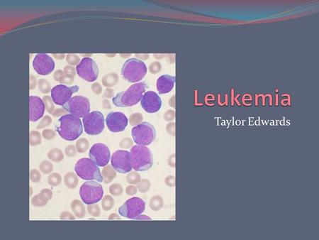 Taylor Edwards. What is Leukemia? Leukemia is a type of blood cancer that begins in the bone marrow. The bone marrow starts making abnormal white blood.