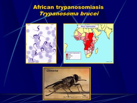 African trypanosomiasis Trypanosoma brucei